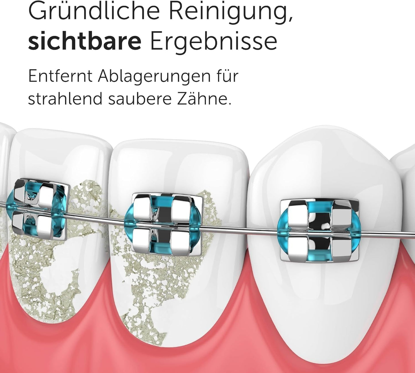 Wondersmile Munddusche PRO - Testsieger 2024-100 Tage risikofrei testen - SmoothFlow-Technologie für optimale Zahn- & Zahnfleischpflege - mit 5 Modi - PowerAkku mit bis zu 30 Tagen Laufzeit