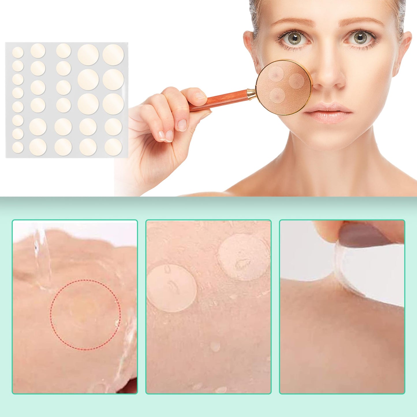 Pimple Patches Hydrokolloid Unsichtbare Pickel Patch mit Teebaumöl Tag und Nacht Verwenden Pimple Patch Akne Patches Wasserdichte Atmungsaktive Acne Patch Pflaster Anti (264 Stück)