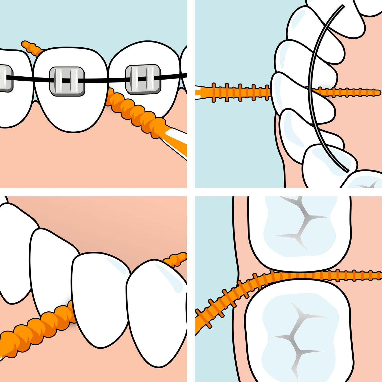 TePe EasyPick Dental Stick XS/S / 1 x 36 Stück inklusive praktischem Taschenetui / Für eine einfache, tägliche Anwendung zwischendurch und unterwegs