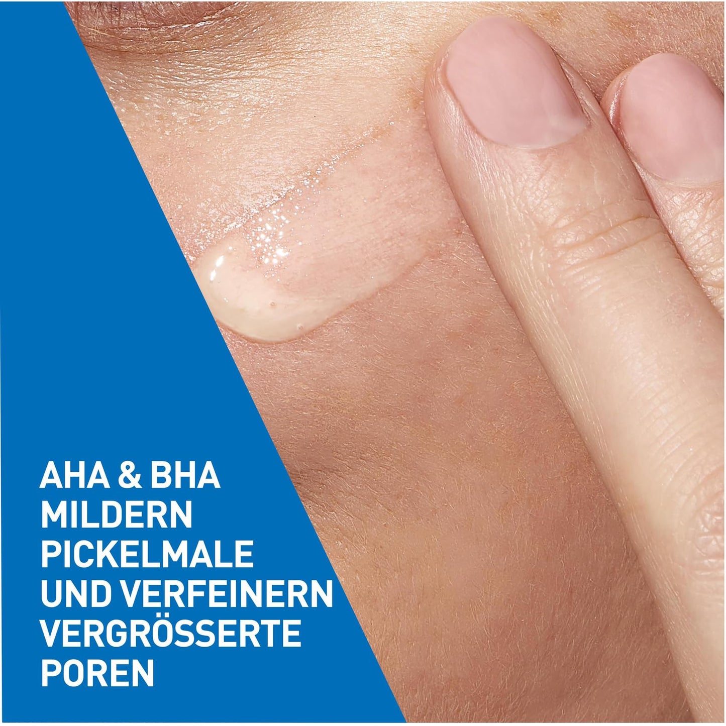 CeraVe Hautbilderneuerndes Retinol Serum, Zuverlässige Pflege bei unreiner und zu Akne neigender Haut, Aufhellender Effekt durch Süßholzwurzelextrakt, Mit 3 essenziellen Ceramiden, 30 ml