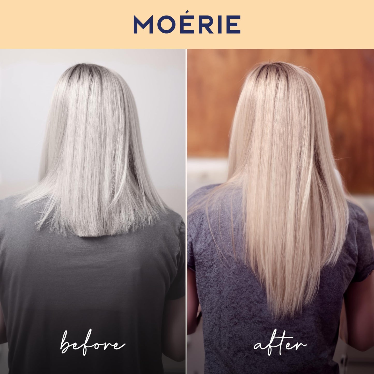 MOERIE Shampoo Set - gegen Haarausfall, Conditioner, Haarwachstum Serum & Haarmaske - natürlich Haarwachstum beschleunigen - Veganes Haarwuchsmittel Frauen & Männer - 77 Mineralien (4er-Set)